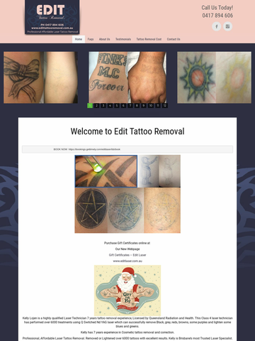 Tattoo Removal Landing Page Template - edittattooremoval.com.au